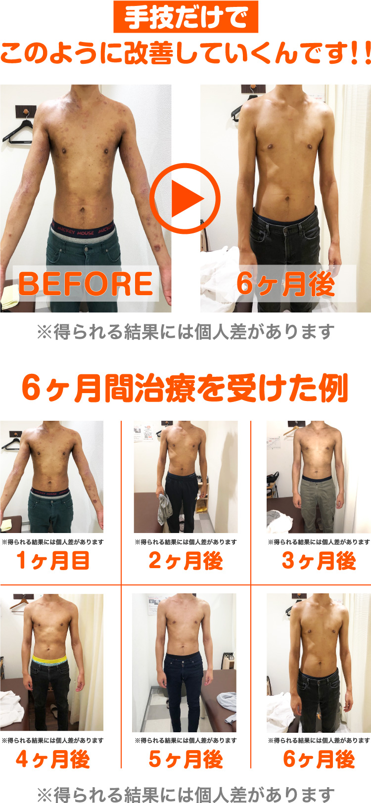 ビフォーアフター